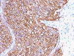 Uroplakin 1A Antibody in Immunohistochemistry (Paraffin) (IHC (P))