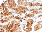 Uroplakin 1A Antibody in Immunohistochemistry (Paraffin) (IHC (P))