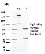 Uroplakin 1A Antibody in SDS-PAGE (SDS-PAGE)