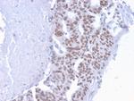 CHD4 Antibody in Immunohistochemistry (Paraffin) (IHC (P))