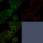 CHD4 Antibody in Immunocytochemistry (ICC/IF)