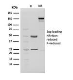 CHD4 Antibody in SDS-PAGE (SDS-PAGE)