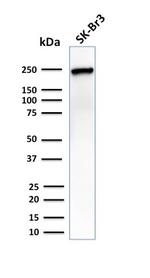 CHD4 Antibody in Western Blot (WB)