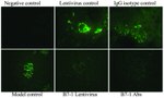 CD80 (B7-1) Antibody in Immunohistochemistry (IHC)