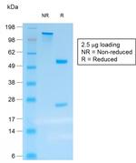 Chromogranin A/CHGA Antibody in SDS-PAGE (SDS-PAGE)