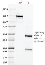 Chromogranin A/CHGA (Neuroendocrine Marker) Antibody in SDS-PAGE (SDS-PAGE)