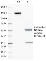 Chromogranin A/CHGA (Neuroendocrine Marker) Antibody in SDS-PAGE (SDS-PAGE)