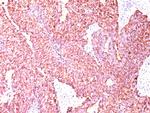 Chromogranin A/CHGA (Neuroendocrine Marker) Antibody in SDS-PAGE (SDS-PAGE)