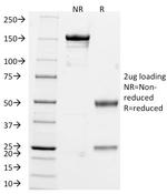 Chromogranin A/CHGA (Neuroendocrine Marker) Antibody in SDS-PAGE (SDS-PAGE)