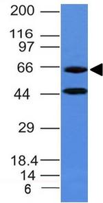 Chromogranin A/CHGA (Neuroendocrine Marker) Antibody in Western Blot (WB)