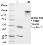 Chromogranin A/CHGA Antibody in SDS-PAGE (SDS-PAGE)