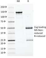 Chromogranin A/CHGA (Neuroendocrine Marker) Antibody in SDS-PAGE (SDS-PAGE)