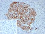 Chromogranin B/CHGB (Neuroendocrine Marker) Antibody in Immunohistochemistry (Paraffin) (IHC (P))