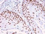 DMC1 Antibody in Immunohistochemistry (Paraffin) (IHC (P))