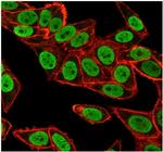 CHEK2 Antibody in Immunocytochemistry (ICC/IF)