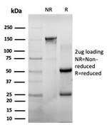 CHEK2 Antibody in SDS-PAGE (SDS-PAGE)