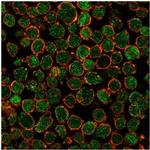 CHEK2 Antibody in Immunocytochemistry (ICC/IF)