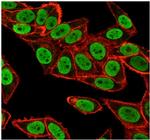 CHEK2 Antibody in Immunocytochemistry (ICC/IF)