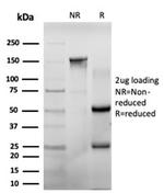 CHEK2 Antibody in Immunoelectrophoresis (IE)