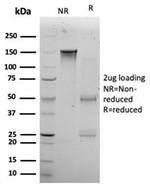 KLF12 Antibody in SDS-PAGE (SDS-PAGE)