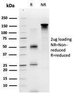 ECD/ SGT1 Antibody in SDS-PAGE (SDS-PAGE)