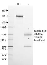 GPN1/XAB1 (DNA Repair and Protein Synthesis) Antibody in SDS-PAGE (SDS-PAGE)