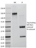 Creatine Kinase-BB (CK-BB) Antibody in SDS-PAGE (SDS-PAGE)