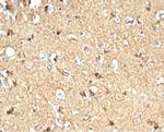 Creatine Phosphokinase-BB (CK-BB) Antibody in Immunohistochemistry (Paraffin) (IHC (P))