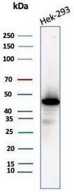 Creatine Phosphokinase-BB (CK-BB) Antibody in Western Blot (WB)