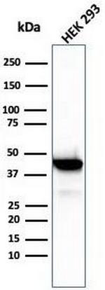 Creatine Phosphokinase-BB (CK-BB) Antibody in Western Blot (WB)