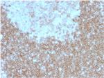 CD268/BAFFR/TNFRSF13C Antibody in Immunohistochemistry (Paraffin) (IHC (P))