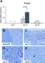 FOXP3 Antibody in Immunohistochemistry (Paraffin) (IHC (P))