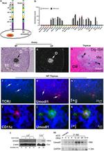 TCR beta Antibody in Western Blot, Immunohistochemistry (WB, IHC)