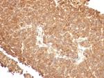 Topoisomerase I, Mitochondrial (TOP1MT) Antibody in Immunohistochemistry (Paraffin) (IHC (P))