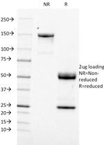 Topoisomerase I, Mitochondrial (TOP1MT) Antibody in SDS-PAGE (SDS-PAGE)