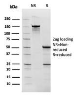 Topoisomerase (DNA) I, Mitochondrial (TOP1MT) Antibody in SDS-PAGE (SDS-PAGE)