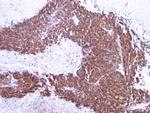 Topoisomerase (DNA) I, Mitochondrial (TOP1MT) Antibody in Immunohistochemistry (Paraffin) (IHC (P))