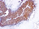 Topoisomerase (DNA) I, Mitochondrial (TOP1MT) Antibody in Immunohistochemistry (Paraffin) (IHC (P))