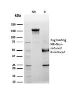 LRG1/Leucine Rich alpha-2-glycoprotein 1 Antibody in SDS-PAGE (SDS-PAGE)