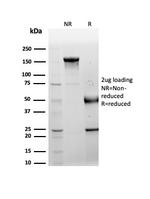 LRG1/Leucine Rich alpha-2-glycoprotein 1 Antibody in Immunoelectrophoresis (IE)