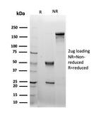 LRG1/Leucine Rich alpha-2-glycoprotein 1 Antibody in Immunoelectrophoresis (IE)