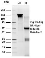 TADA1 (Transcriptional Adapter 1)/STAF42 Antibody in Immunoelectrophoresis (IE)