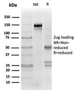 Clusterin/Apolipoprotein J (APO-J) Antibody in SDS-PAGE (SDS-PAGE)