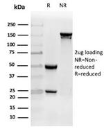 Clusterin/Apolipoprotein J (APO-J) Antibody in SDS-PAGE (SDS-PAGE)