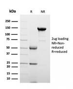 Clusterin/Apolipoprotein J (APO-J) Antibody in SDS-PAGE (SDS-PAGE)