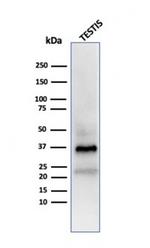 Clusterin/Apolipoprotein J (APO-J) Antibody in Western Blot (WB)