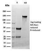 Clusterin/Apolipoprotein J (APO-J) Antibody in SDS-PAGE (SDS-PAGE)