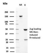 Clusterin/Apolipoprotein J (APO-J) Antibody in SDS-PAGE (SDS-PAGE)