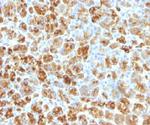 Alpha-1-Antichymotrypsin (SERPINA3) (Histiocytoma Marker) Antibody in Immunohistochemistry (Paraffin) (IHC (P))