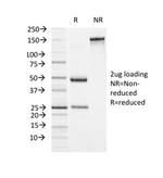 Alpha-1-Antichymotrypsin (SERPINA3) (Histiocytoma Marker) Antibody in SDS-PAGE (SDS-PAGE)